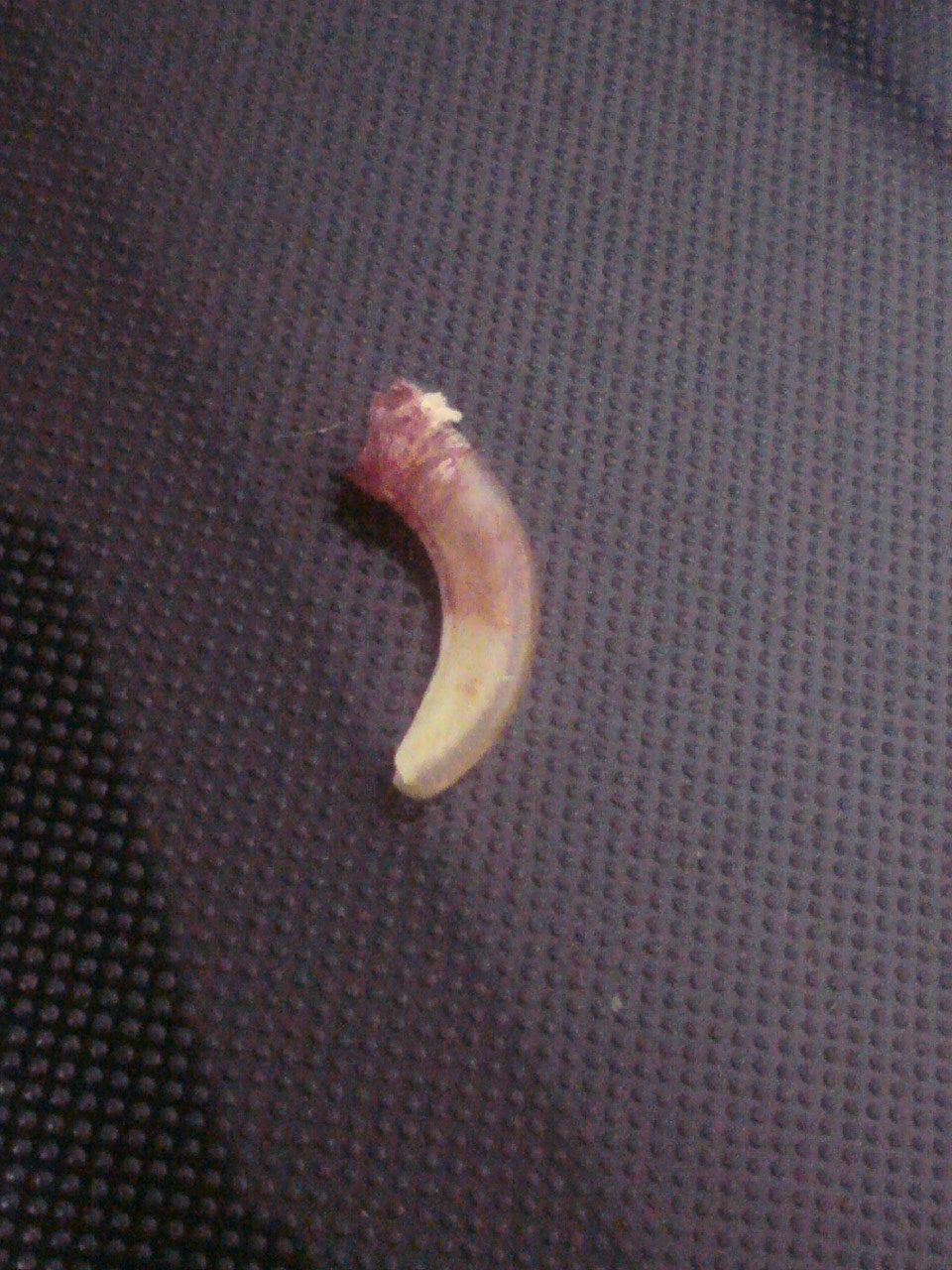 爪がおれちゃったよぉ～（TOT